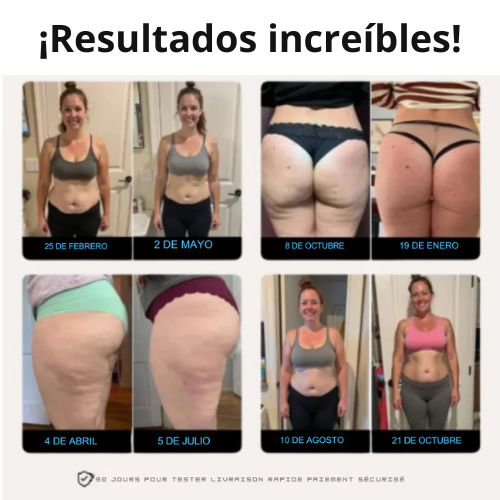 Leggings anticelulíticos[compra 1 y llévate2]